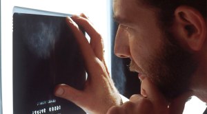 Radiologist examining an xray of a possible tumor due to testicular cancer